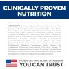Hill’s Science Diet Perfect Digestion, Adult 1-6, Digestive Support, Dry Dog Food, Chicken, Brown Rice, & Whole Oats, 22 lb Bag(Chicken  Brown Rice  & Whole Oats)